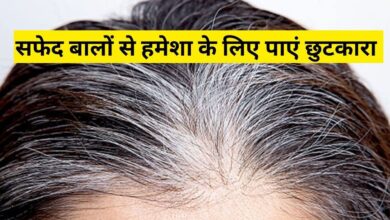 How to stop white hair forever