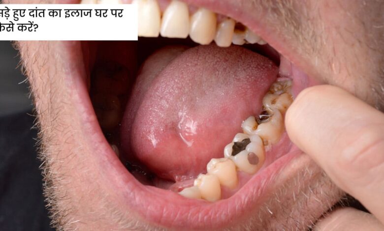 How to treat a rotten teeth at home