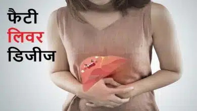 Is Onion good for fatty liver