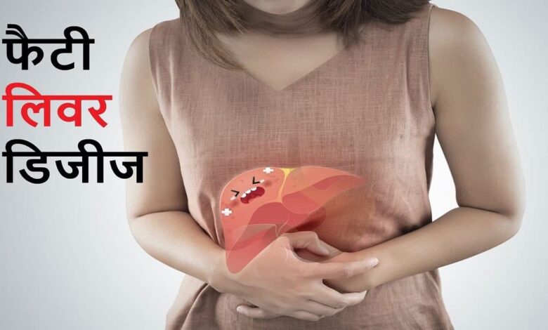 Is Onion good for fatty liver