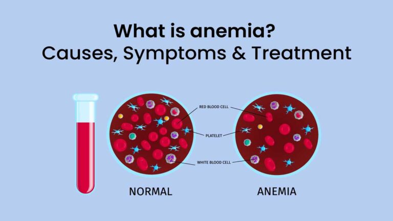 Anemia क्या है? जानिए इसके लक्षण, निदान और उपाय