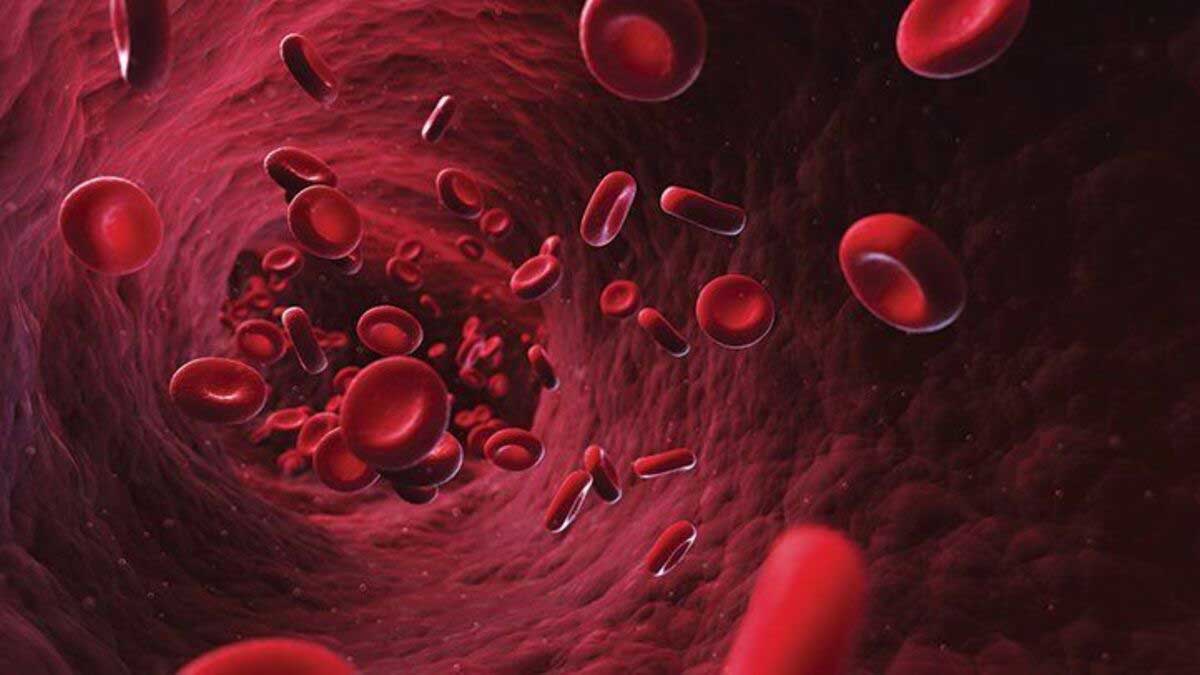 What is anemia Know its symptoms, diagnosis and remedies