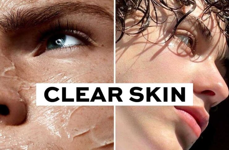 What to eat and not to eat to get clear skin