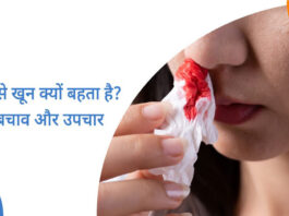 What to eat to stop Nose Bleeding