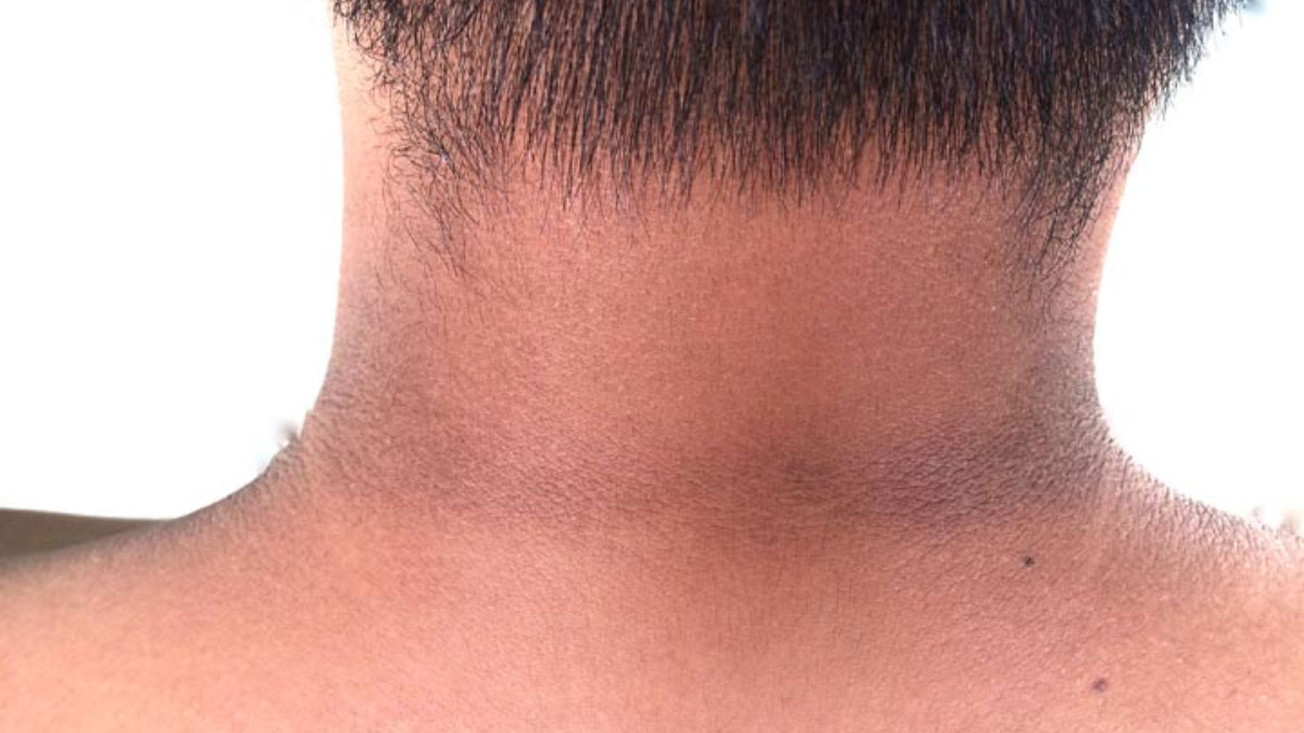 Clean the dark skin of the Neck like this