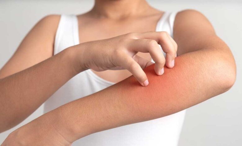 Easy ways to stop skin allergies immediately