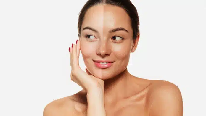 If your skin is burnt in summer, then mix this cold thing with Gram flour
