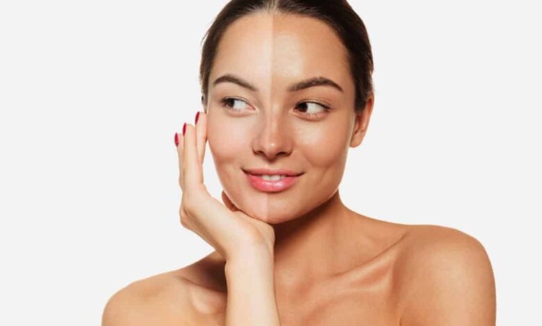 If your skin is burnt in summer, then mix this cold thing with Gram flour