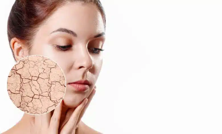 If your skin is getting dry due to continuous sitting in AC, then give it moisture in this way