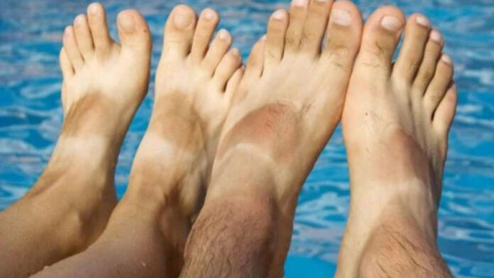 Tanning on legs will go away, apply these things by mixing them in toothpaste