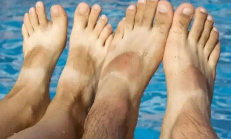 Tanning on legs will go away, apply these things by mixing them in toothpaste