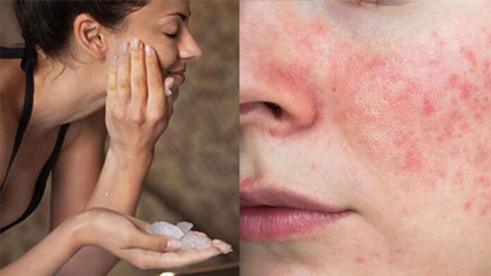 These are the 7 disadvantages of applying alum on the face