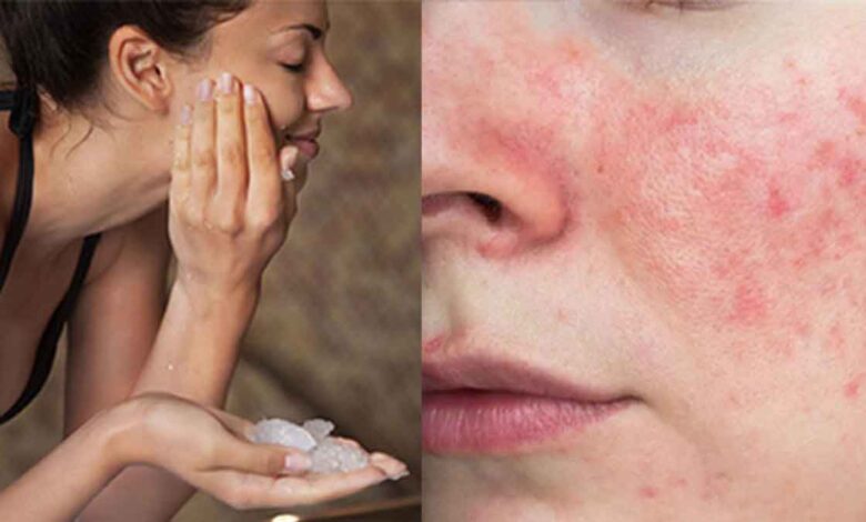These are the 7 disadvantages of applying alum on the face