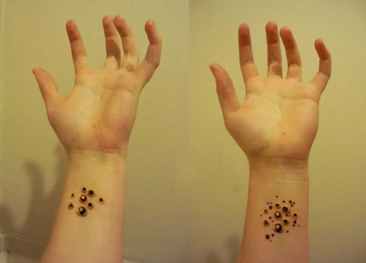 Trypophobia: Are you afraid of holes?