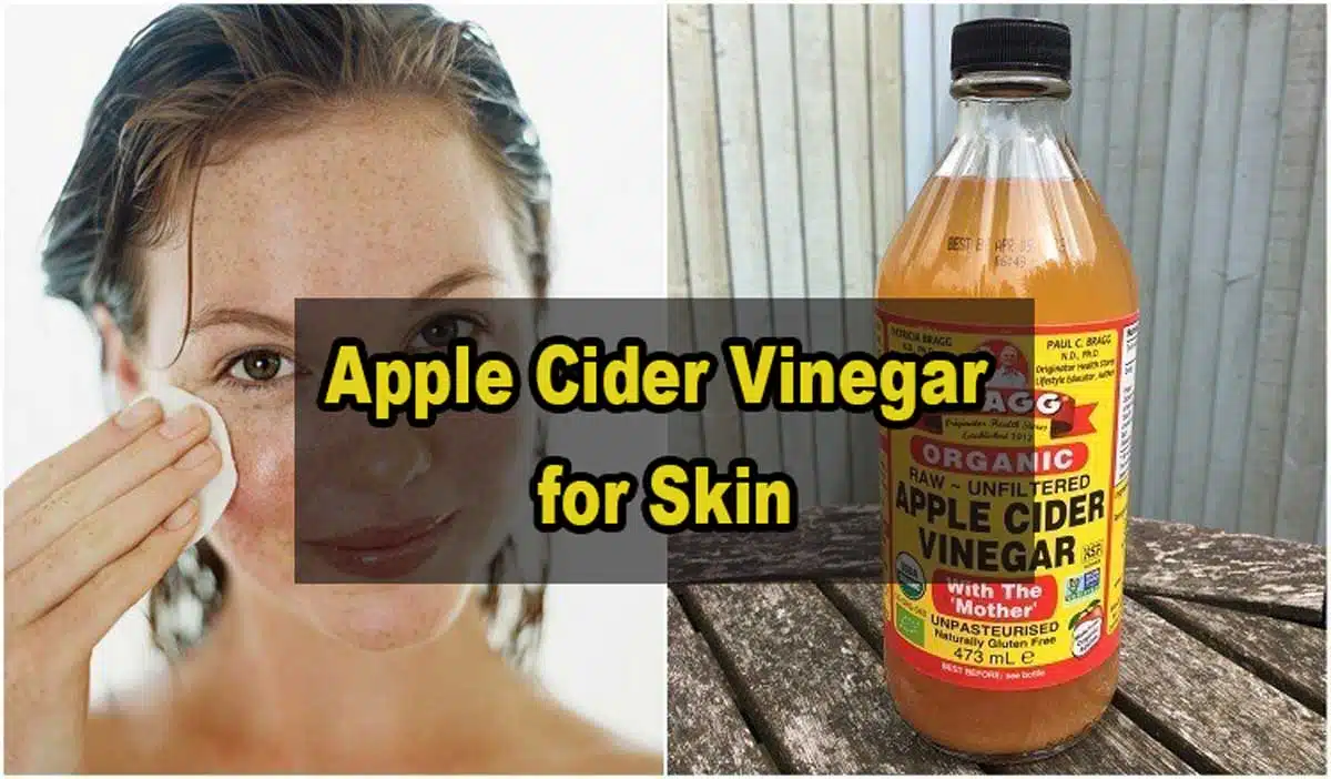 Uses of Apple Cider Vinegar for Skin, Hair and Weight Loss