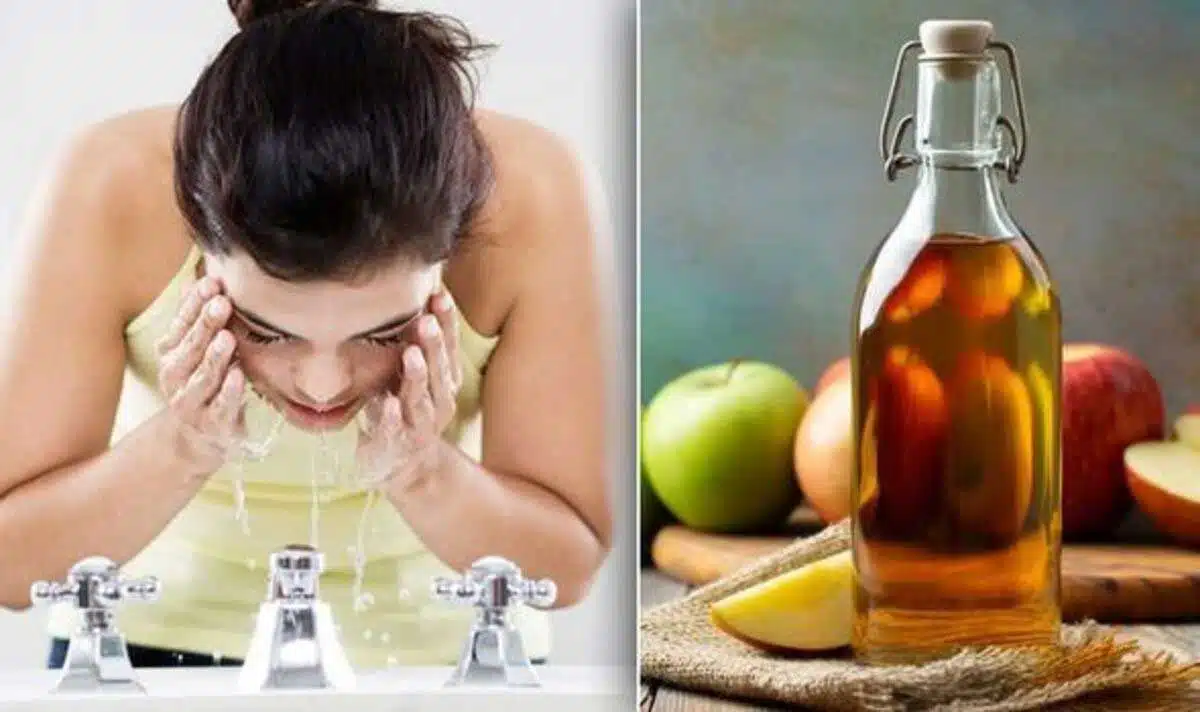 Uses of Apple Cider Vinegar for Skin, Hair and Weight Loss