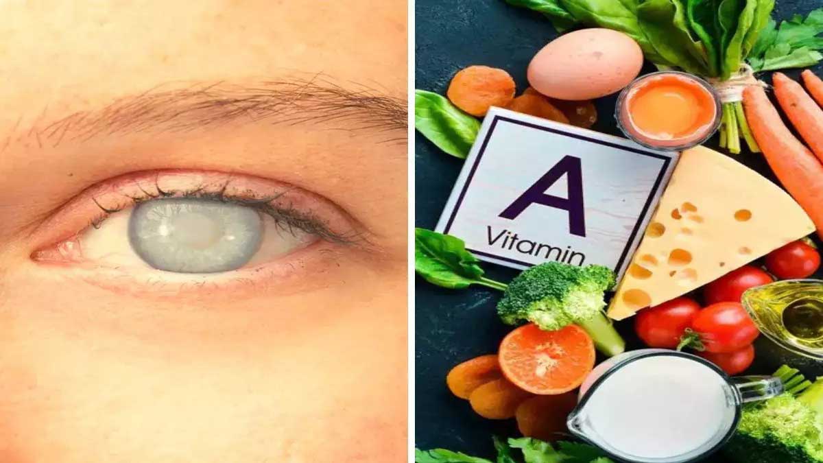 What happens to the face due to deficiency of Vitamin C