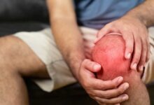 What is Arthritis Know its types, symptoms and diagnosis