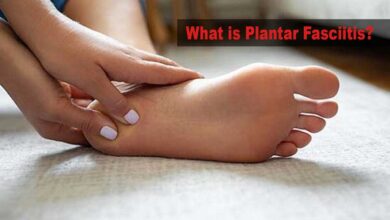 What is Plantar Fasciitis and how to treat it