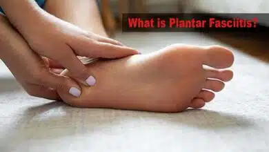 What is Plantar Fasciitis and how to treat it