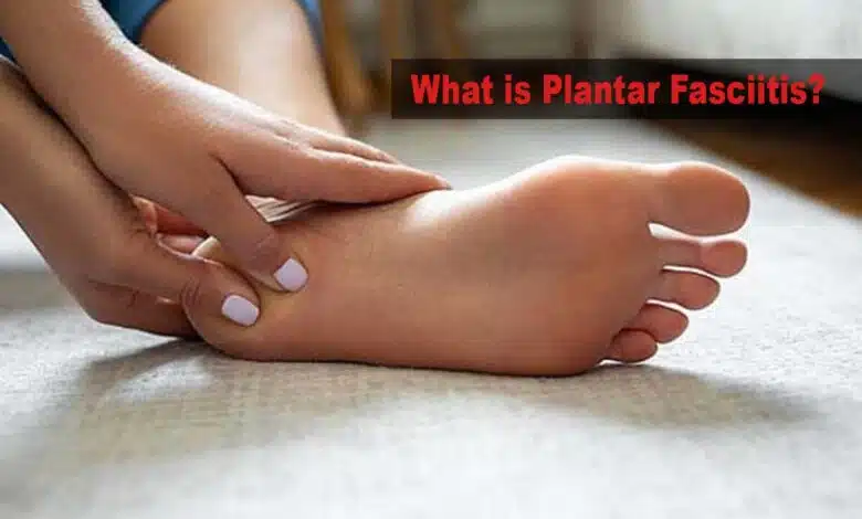 What is Plantar Fasciitis and how to treat it