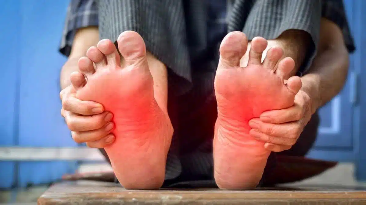 What is Plantar Fasciitis and how to treat it 2 What is Plantar Fasciitis and how to treat it