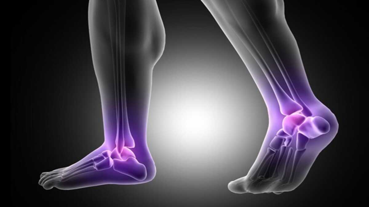 What is Plantar Fasciitis and how to treat it