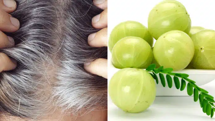 These 5 home remedies will reduce white hair