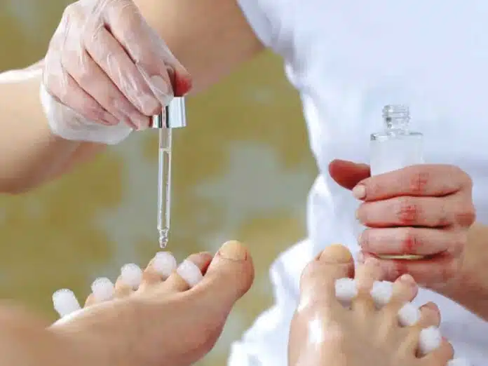 Use tea tree oil to get rid of nail fungus