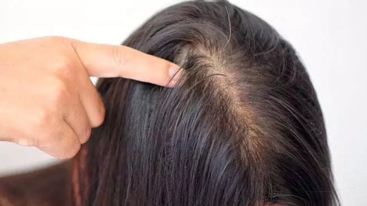 10 Benefits of Applying Coconut Oil to Grow Hair Longer