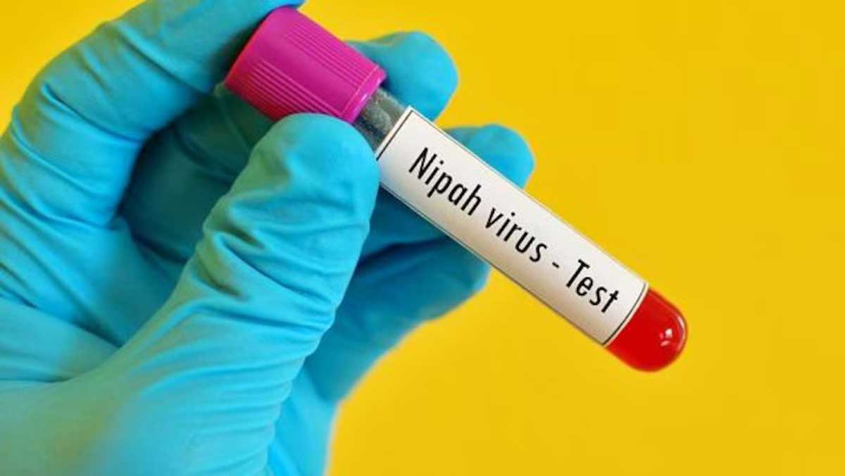 14 year old boy infected with Nipah virus dies in Kerala