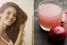 Apply Onion juice to your hair in this way, hair fall will stop and hair growth will also be good