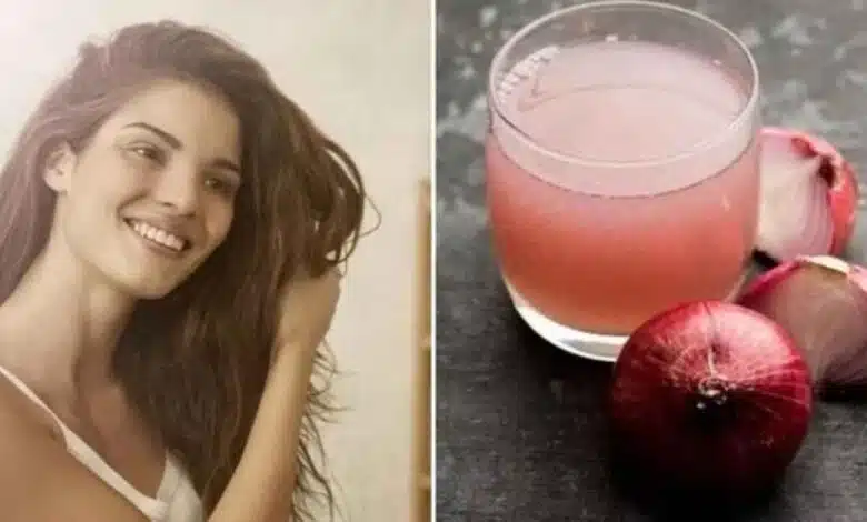 Apply Onion juice to your hair in this way, hair fall will stop and hair growth will also be good