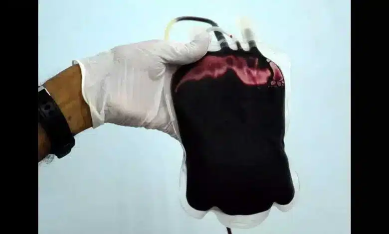 CMHO dismissed 3 people in blood black marketing case in Madhya Pradesh