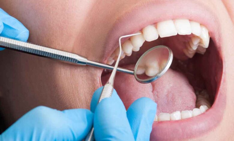Can you clean your Teeth with lemon and baking soda