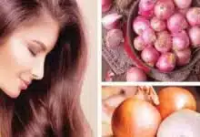 Is Onion Juice effective in preventing hair fall and promoting hair growth