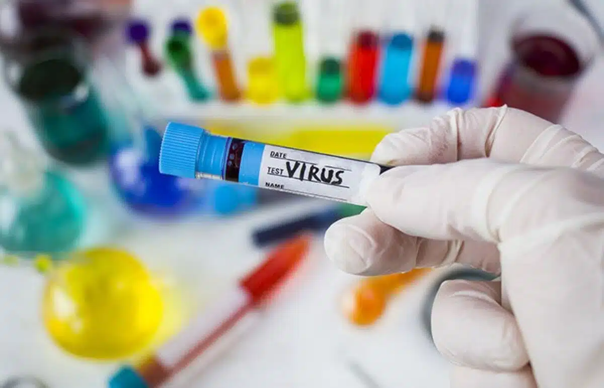 37 cases of Chandipura virus reported in Gujarat