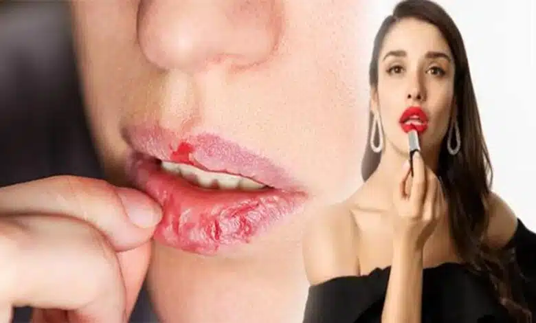 Which disease can be caused by applying lipstick 3