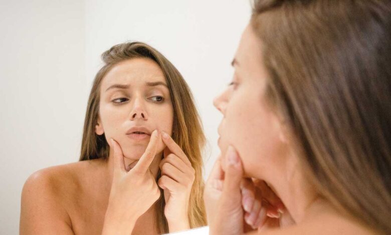 10 Home Remedies to Remove Blackheads