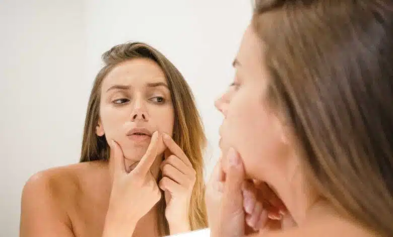 10 Home Remedies to Remove Blackheads