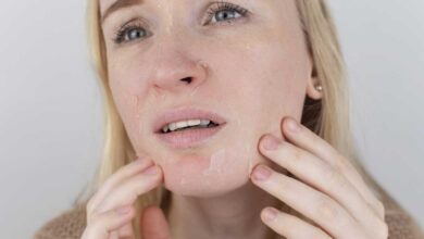 Eliminate Dry Skin the magic of home remedies!