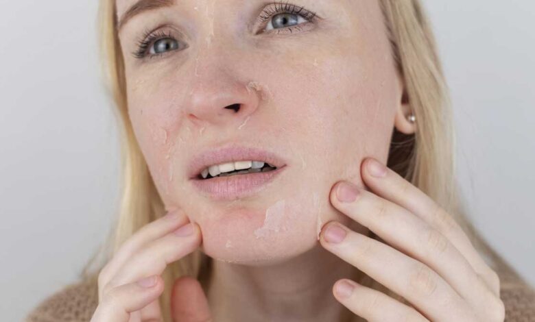 Eliminate Dry Skin the magic of home remedies!