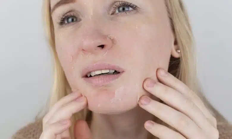 Eliminate Dry Skin the magic of home remedies!