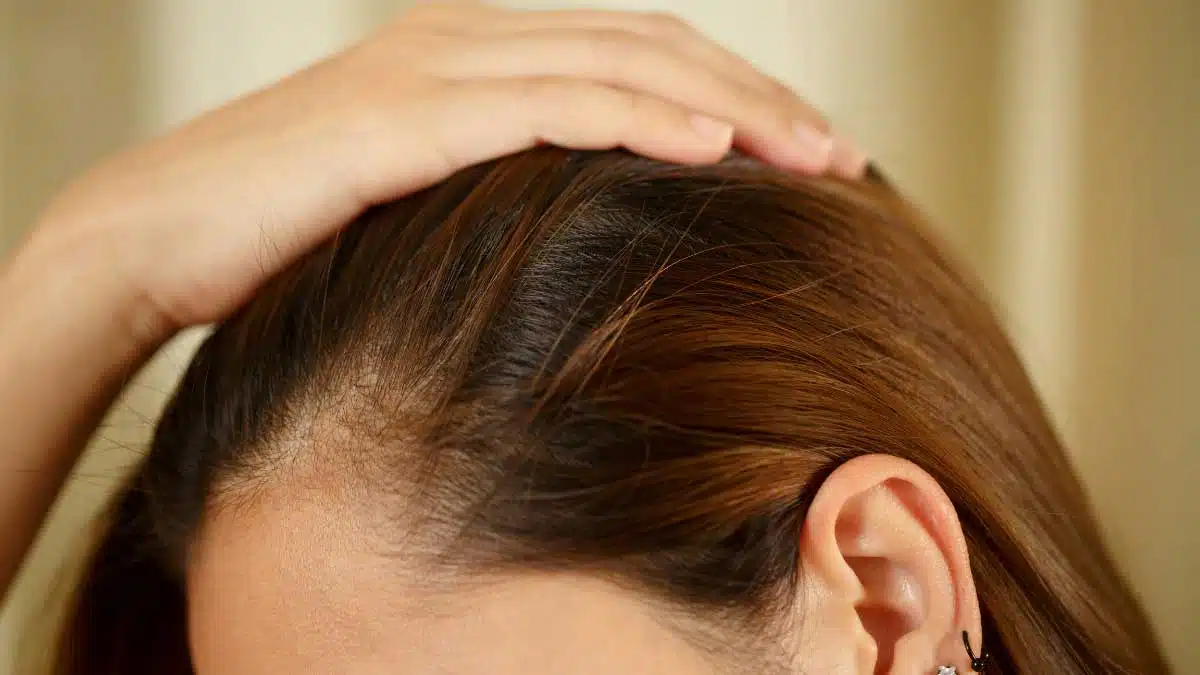 Get rid of Hair Fall with this homemade botox cream!