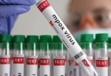 Health Ministry advises states and union territories regarding Monkeypox