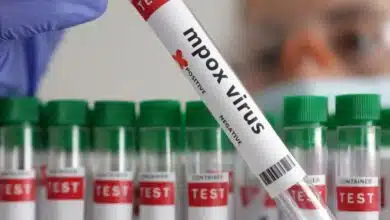 Health Ministry advises states and union territories regarding Monkeypox