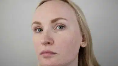 Home remedies to get rid of Dry Skin