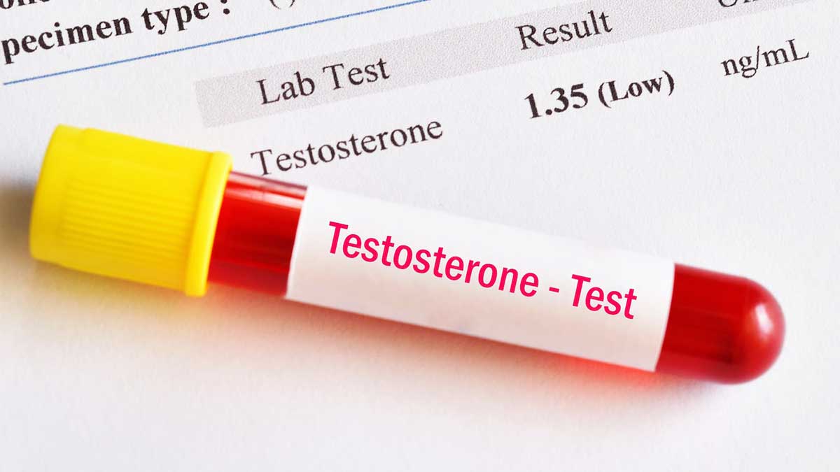 4 Factors That Cause Low Testosterone Levels