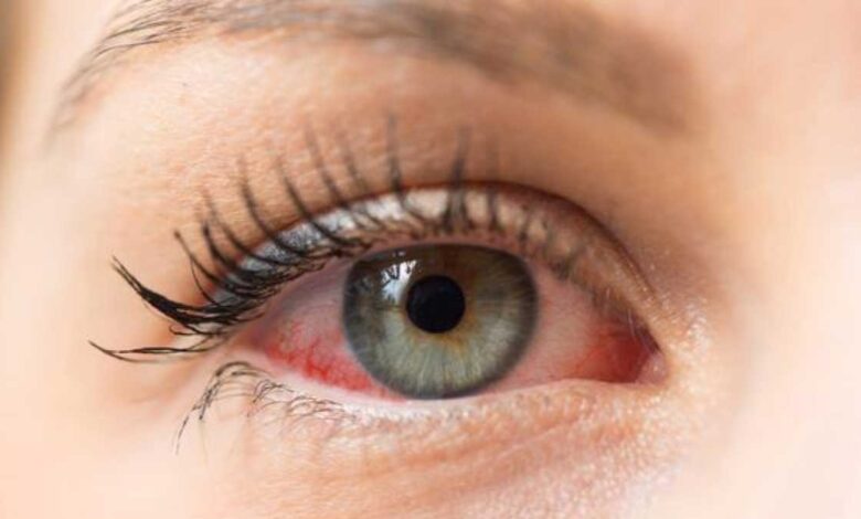 Should Dry Eyes be washed frequently or not
