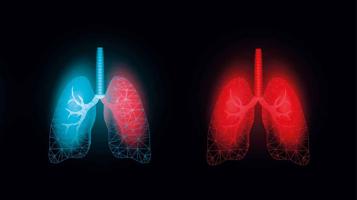 15 percent increase in respiratory diseases due to air pollution in Delhi